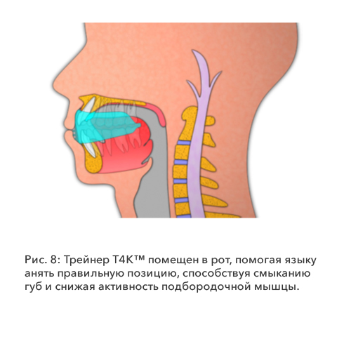 Рис. 8: Трейнер T4K™ 