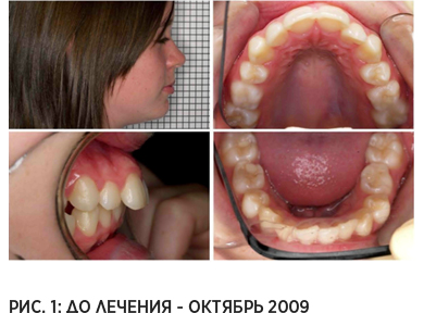Рис. 1: До лечения - октябрь 2009