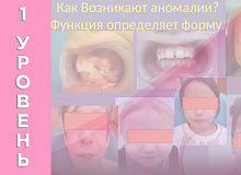 Введение. Миофункциональная ортодонтия