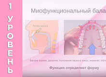 Миофункция, почему это важно